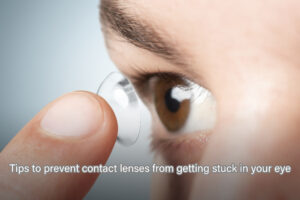 Tips to prevent contact lenses from getting stuck in your eye